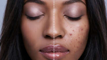 Medical Dermatology